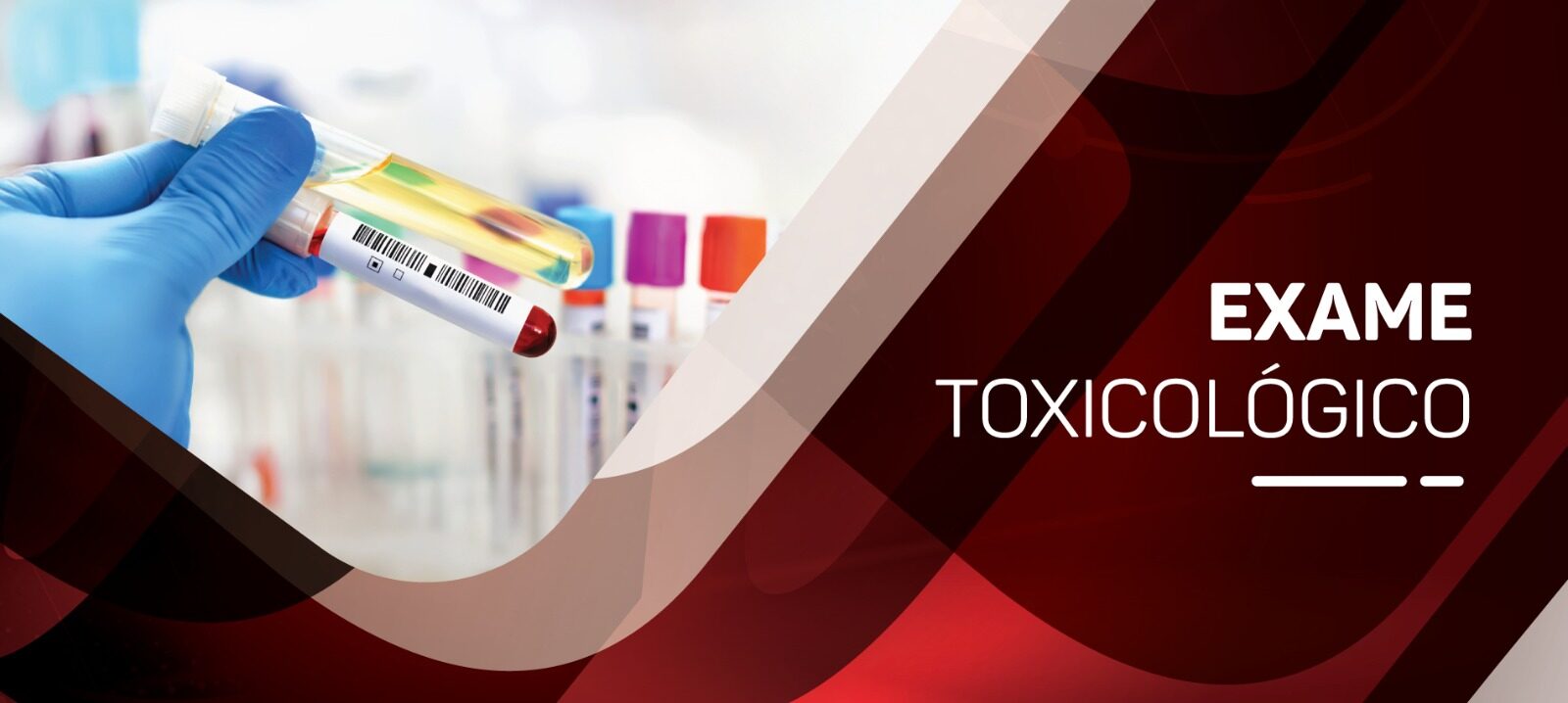 Exame Toxicológico